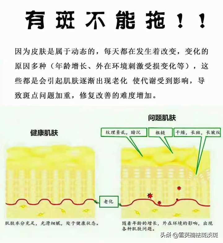 好用的祛斑护肤品推荐测评,拒绝盲选如何选择淡斑护肤品