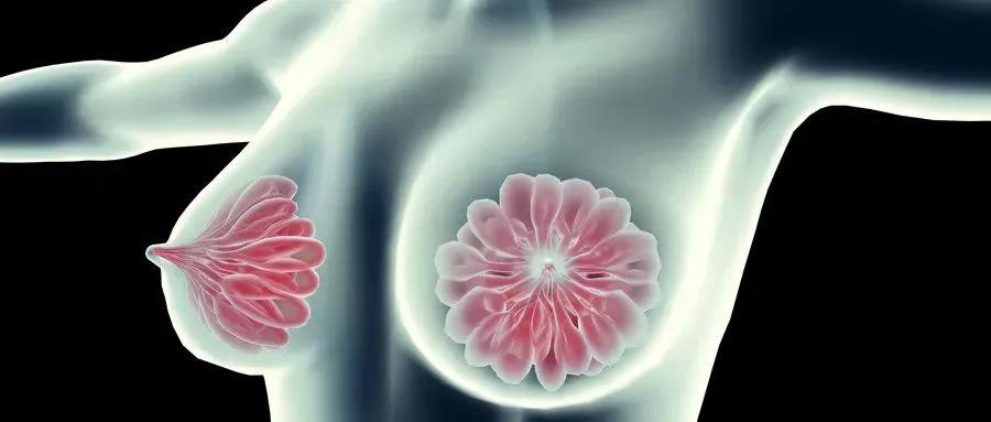 结节囊肿息肉哪一种容易得癌症,结节息肉囊肿