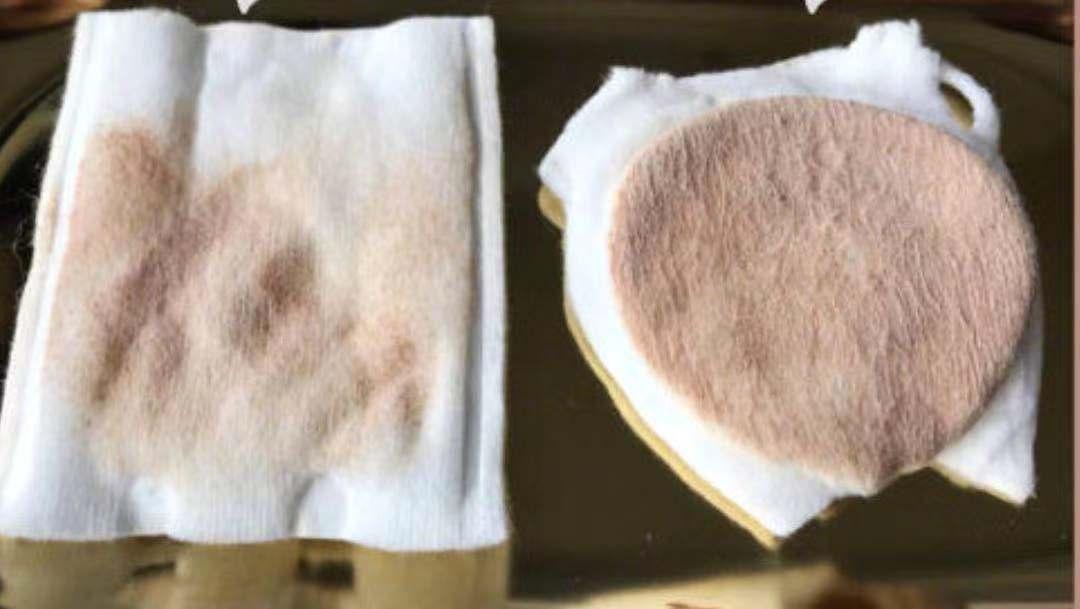 王鸥谈打了瘦脸针,王鸥打过瘦脸针吗