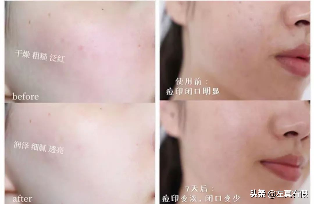 韩国引进的面膜,韩国一款红色的面膜