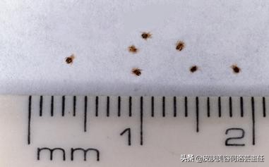 皮肤刷酸后要敷什么面膜好,皮肤刺痛的原因