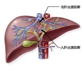 医生做手术时是怎么止血的,做手术流血怎么处理