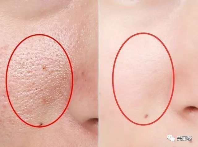 微商大牌化妆品骗局,微商卖的便宜大牌化妆品是真的吗