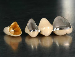 烤瓷牙崩瓷了怎么办,烤瓷牙崩瓷概率高吗