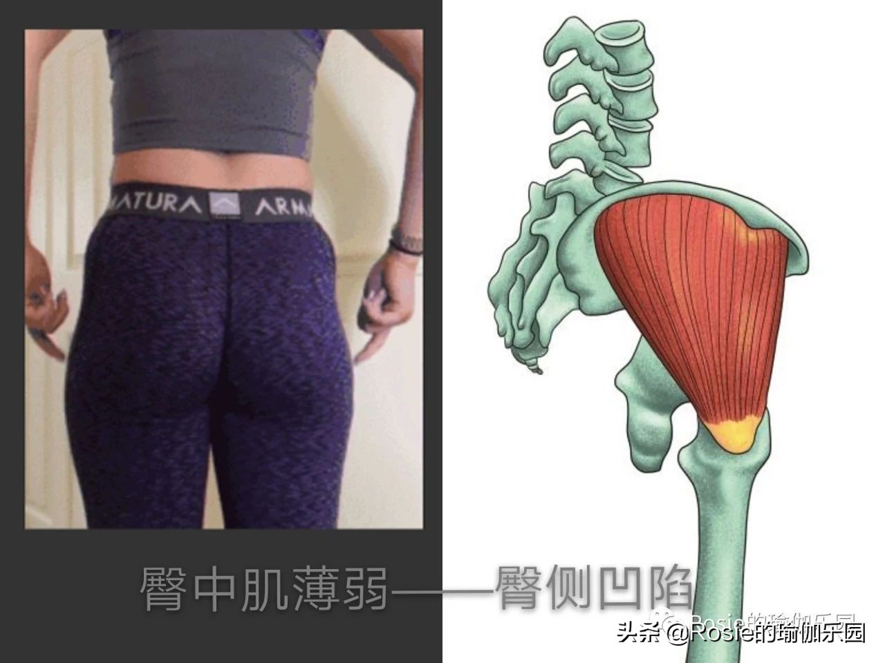 如何知道是真翘臀还是假翘臀,真翘臀和假翘臀是怎么判断的