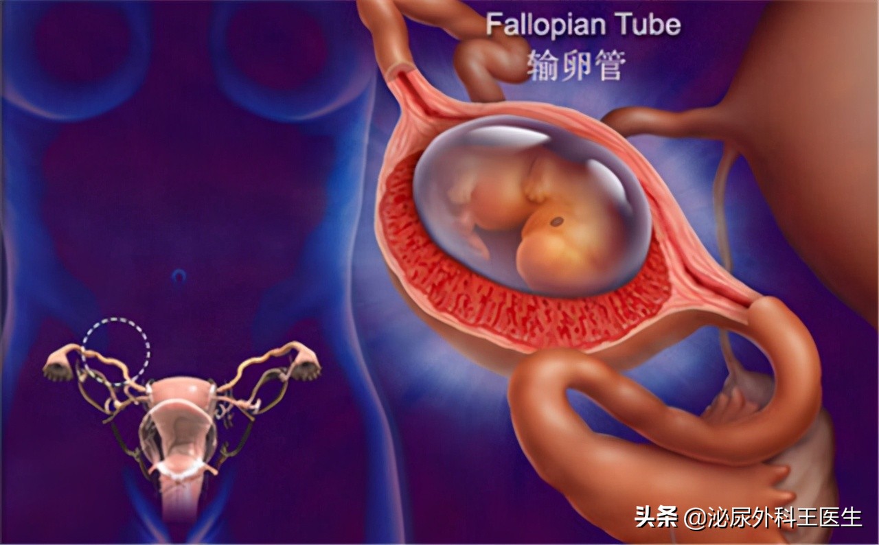阴式b超是查什么的,阴式b超会检查出什么