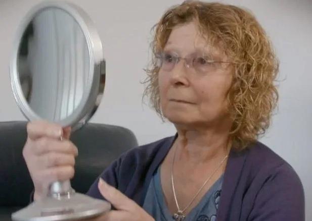 英国女子被假医生注射肉毒杆菌，脸部肿胀像外星人，差点丧命