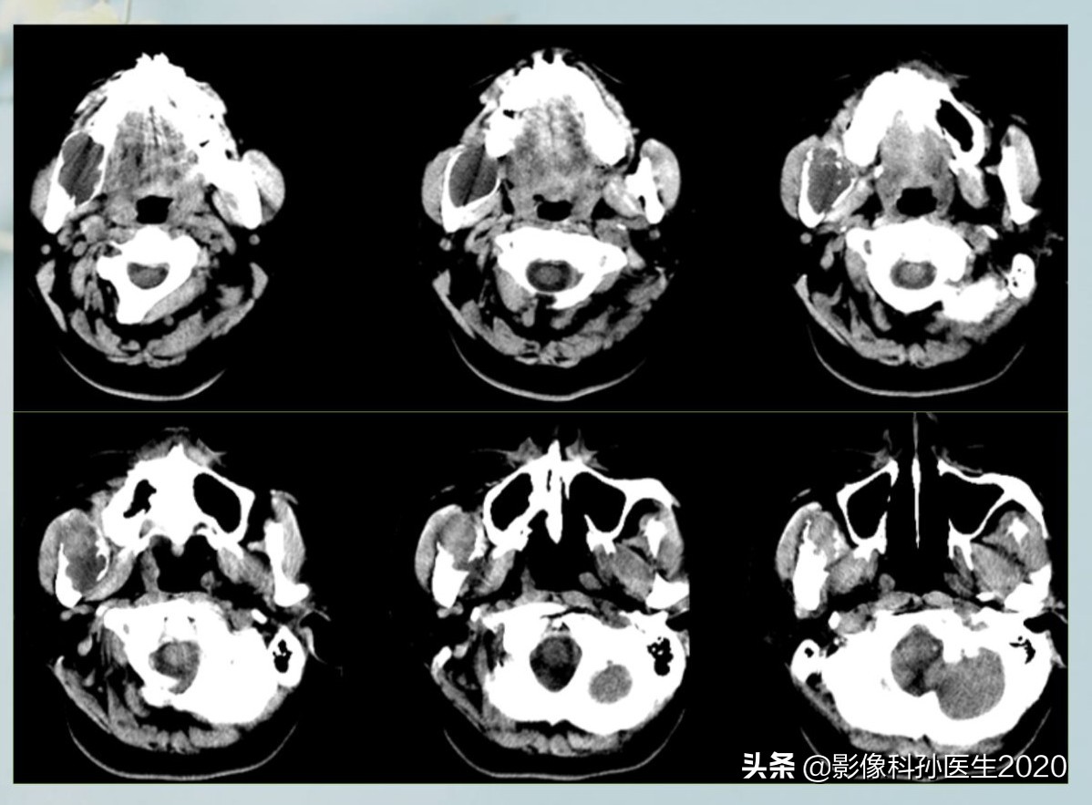 case10什么意思,case案例合集