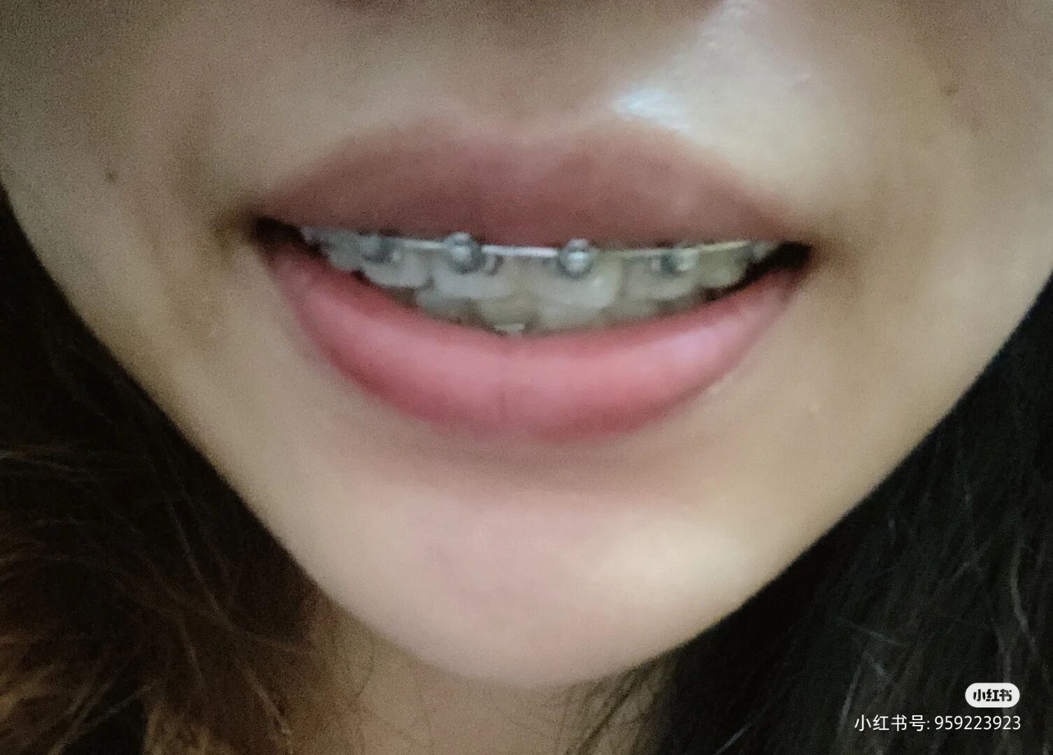 维乐口腔和维乐中泽口腔,福州维乐中泽口腔门诊