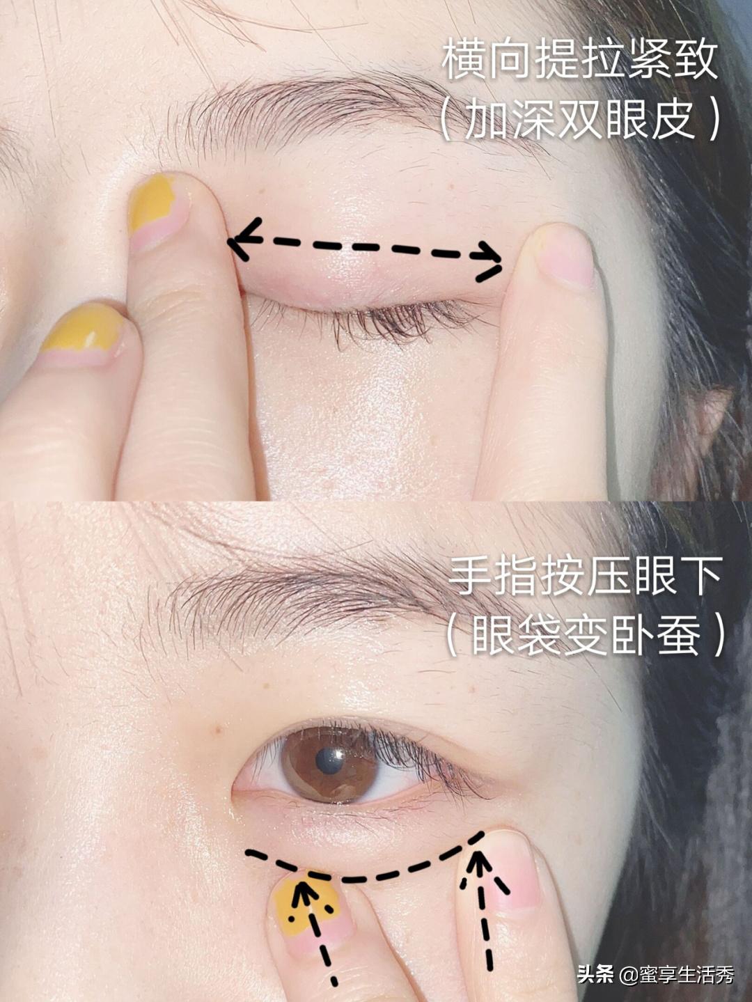 内双眼皮怎么变外双按摩最有效,内双眼皮手术变外双效果