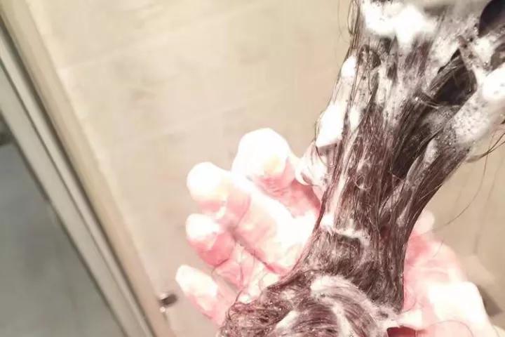 头屑满天飞用的洗发水,头屑一坨一坨的