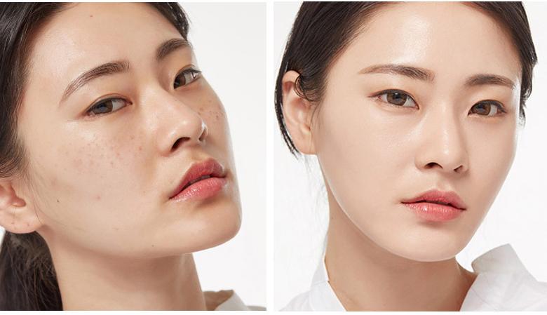 毛孔缩小的过程图,鼻子毛孔怎么缩小