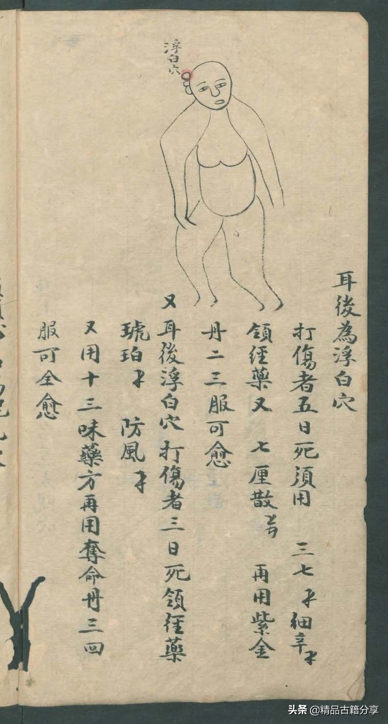 中医类抄本跌打损伤方面的医书欢迎阅读