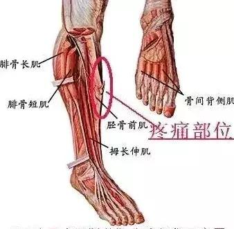 跑步大腿疼和小腿疼有什么区别,跑步之后脚跟疼怎么回事