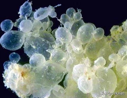 怀孕一定要提防什么病,怀孕引起的葡萄胎有什么症状