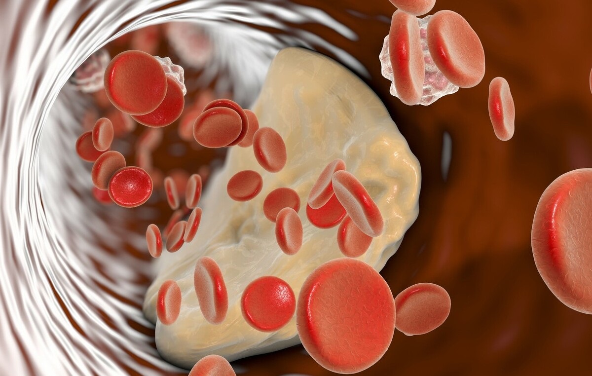 冠心病的联合用药方案有哪些,治疗冠心病的药哪种比较好