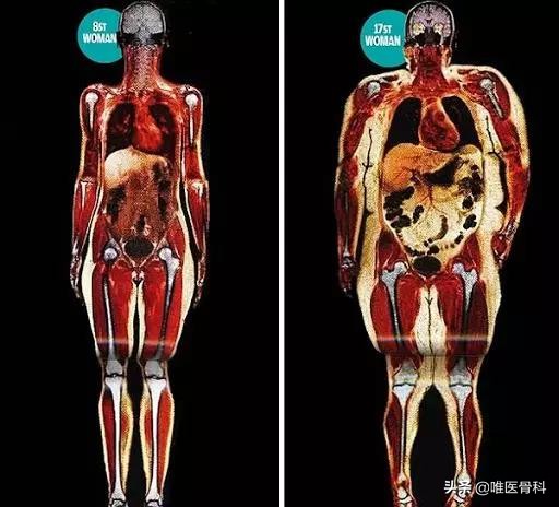 怎样练成逆天大长腿,怎样从小短腿练成大长腿