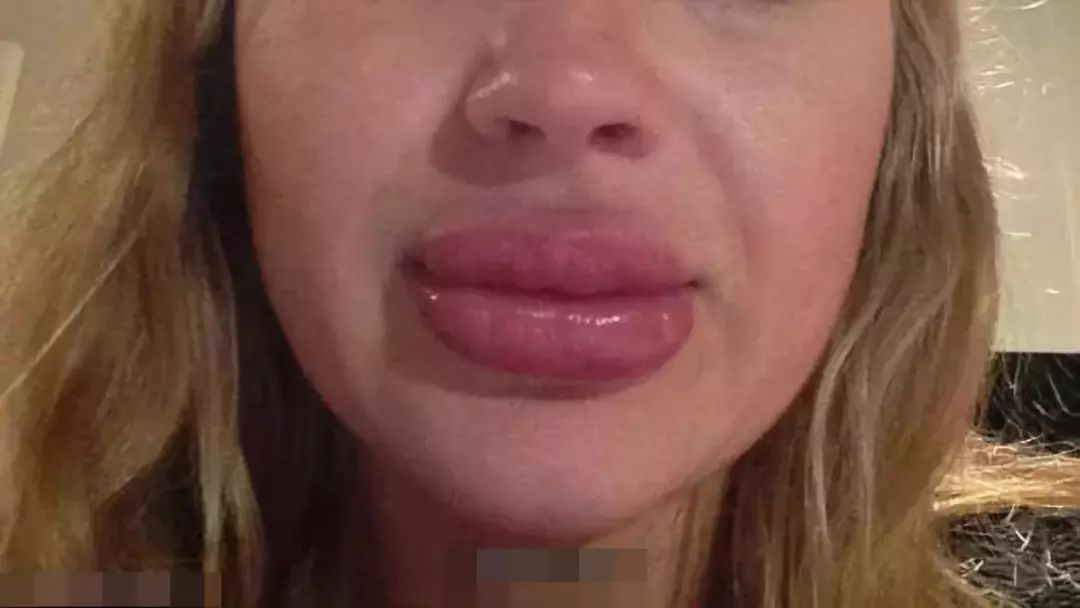 网红花5万赴日本洗血：这些自杀式美容法，正在收割你的智商税