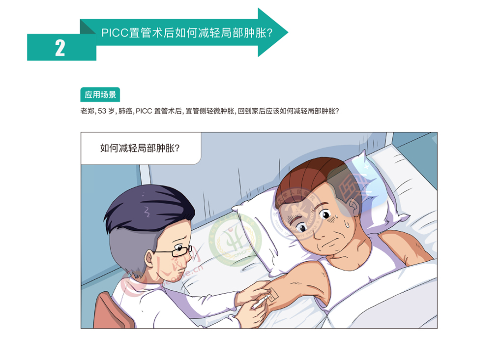 肿瘤患者picc置管主要的并发症,肿瘤病人picc管怎么取出