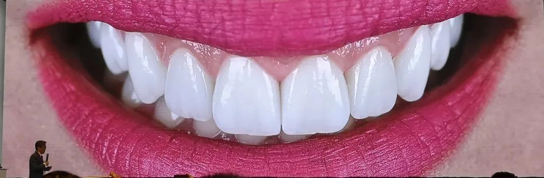 美白牙膏去牙黄真实有效测评,美白牙膏真实测评护牙效果