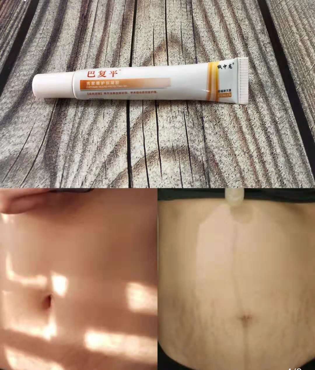 去妊娠纹修复测评推荐,去妊娠纹测评红黑榜