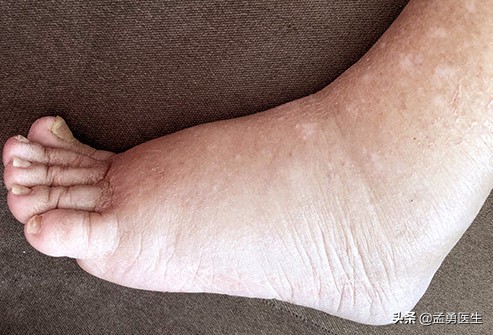 天气热医生科普视频,天气太热了医生提醒