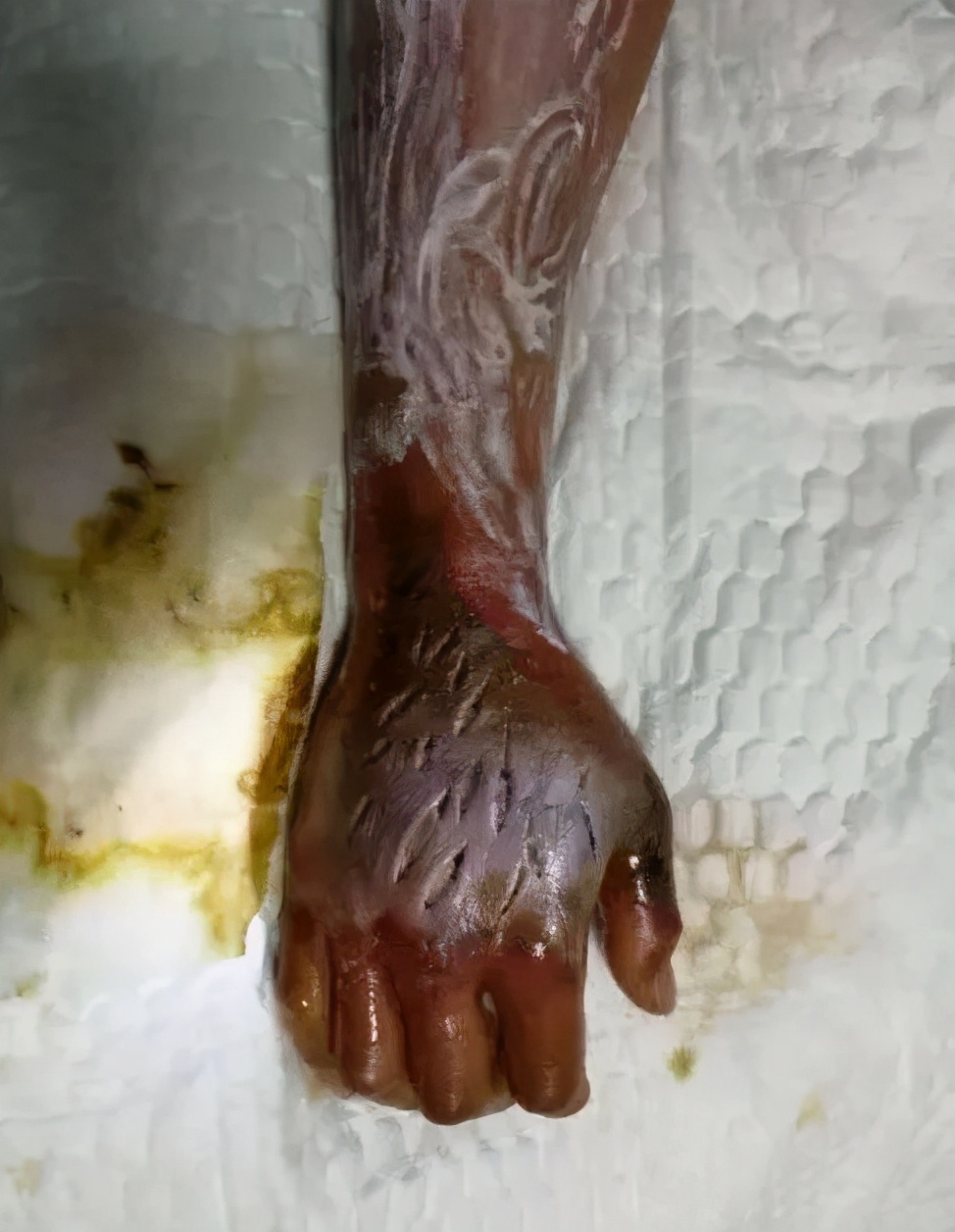 什么蛇最毒咬到了人会怎么样,毒性最强的蛇多久可以致死