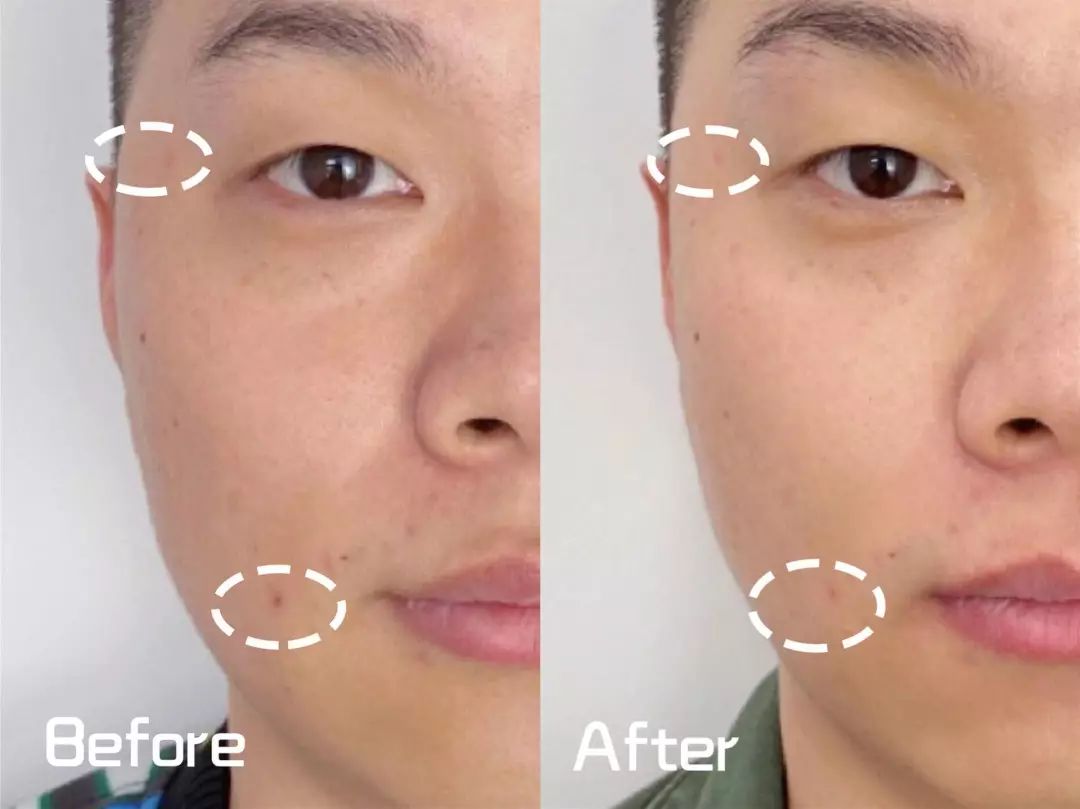 第七代小棕瓶使用感受,小棕瓶值得买吗