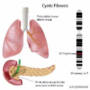 「张院讲故事」男性先天性输精管缺失，还能生个自己的宝宝吗？