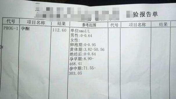 有什么表现证明已经怀孕了,出现这些症状说明你怀孕了