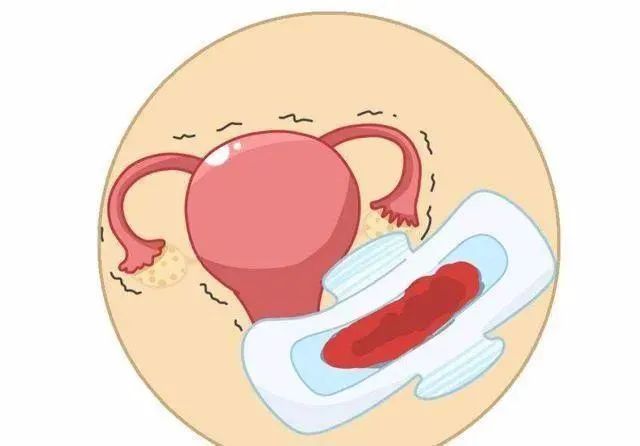 排卵期出血有可能是气血不调吗,排卵期出血可能是宫外孕吗