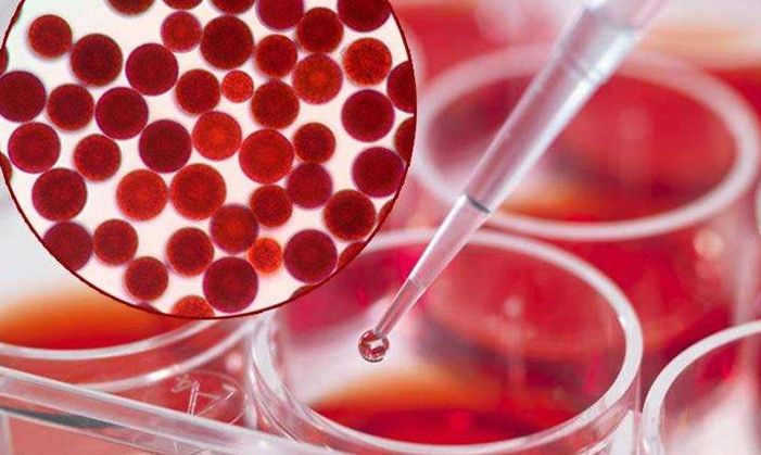 地球最强抗氧化虾青素,虾青素的抗氧化活性综述