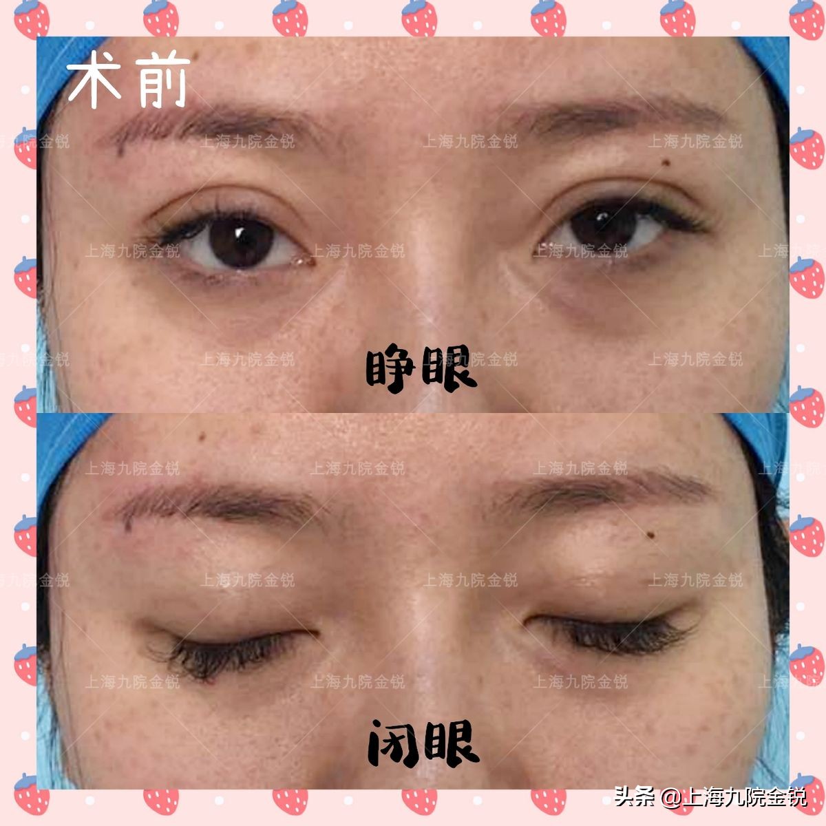 双眼皮VS单眼皮，为什么更多人喜欢双眼皮？