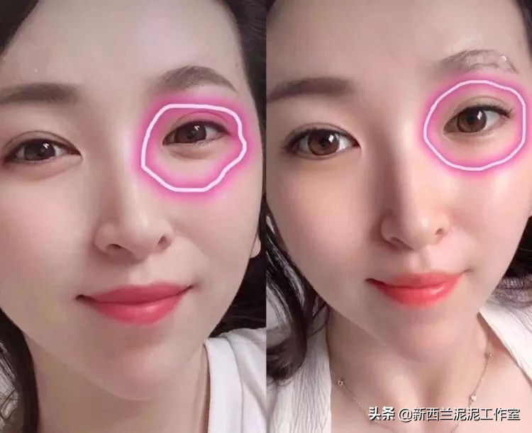 吴昕同款祛黄脸,吴昕眼袋