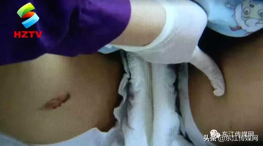 17岁女孩被电晕,女孩在景观池触电事故