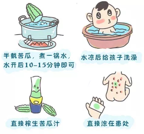 6月份出生的宝宝怎么预防痱子,母婴好物天热了宝宝爱长痱子