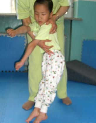 小儿脑性瘫痪的康复评估