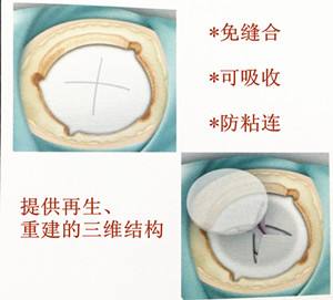 脑膜瘤有些什么症状,脑膜瘤症状有哪些啊