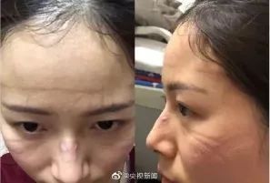 抗击疫情贵州支援恩施,抗击疫情贵州在行动