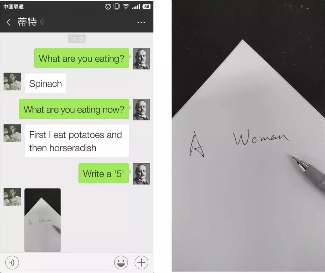 阿尔茨海默病寿命都超不过10年,百年阿尔茨海默病