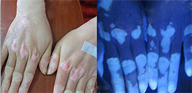 皮肤出现了问题怎么办,皮肤出现问题先修复什么