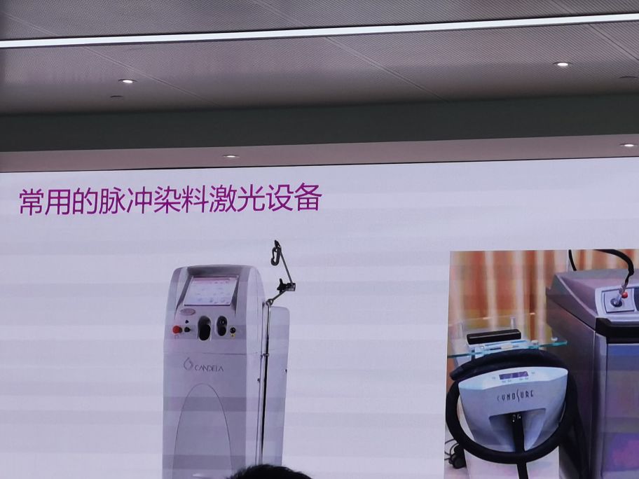 冷冻祛痣和脉冲染料激光,脉冲染料激光祛鲜红斑痣后有红印