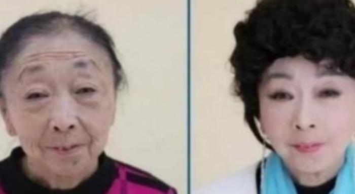 65岁整容老太太现状,60岁老太为爱整容成20岁少女