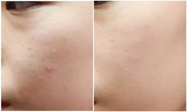 sk-ii神仙水黑色和红色哪个好,sk-ii神仙水参数