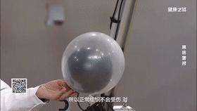 黑痣很容易恶变吗,身上黑痣出现什么状况有癌变发生