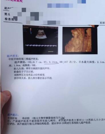 孕早期b超单子怎么看数据,孕早期b超单上怎么看数据