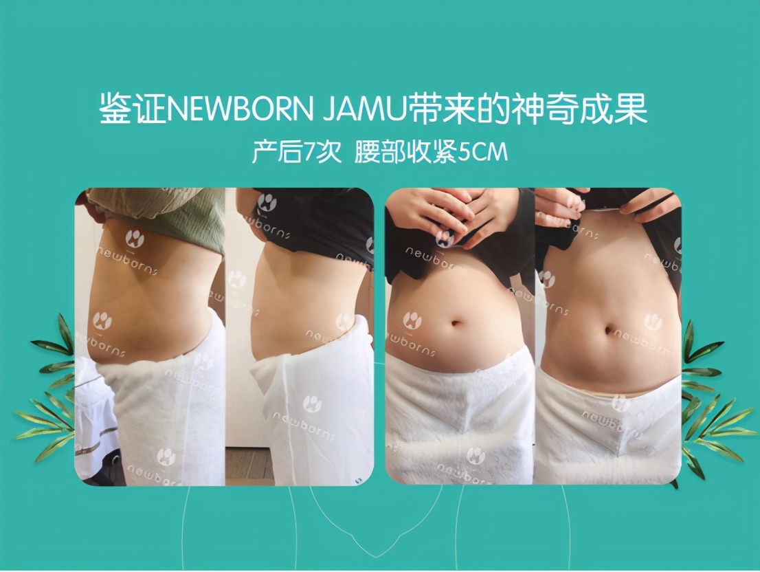 产后肚子大怎么办,生完宝宝你的腹直肌修复了吗?