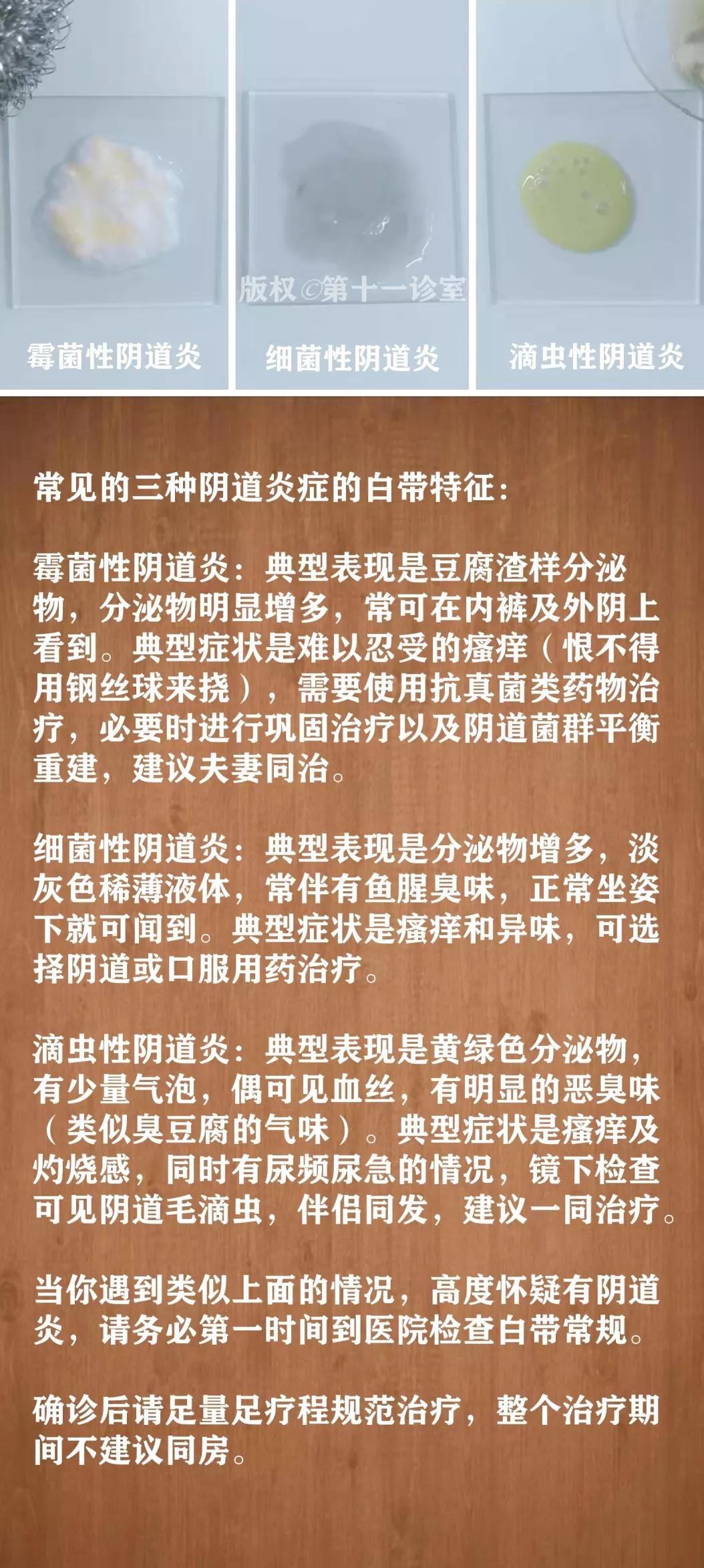 姑娘,关于白带的这些知识,你必须知道