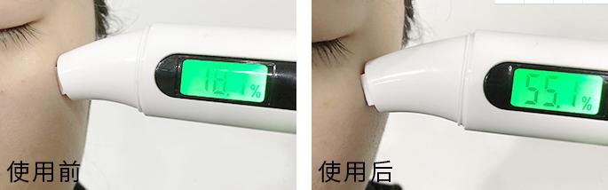 spatreatment紧致抗皱蛇毒眼膜,类蛇毒紧致修复眼膜