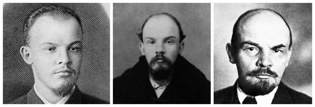 90后“未富先秃”！该拿什么拯救我的发际线？